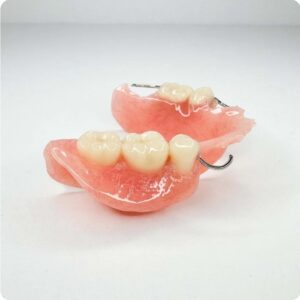 Acrylic Stayplate Partial