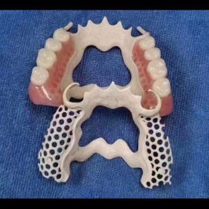 Solvay Ultaire AKP Partial